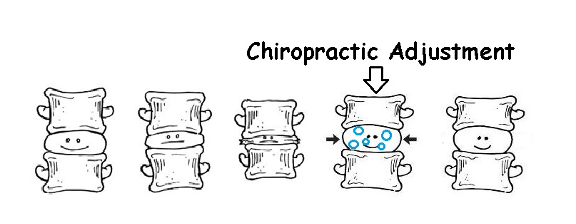 chiropractic helps arthritis