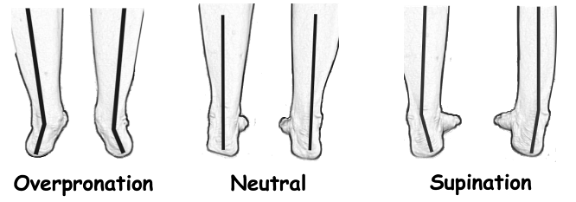 foot over to under pronation